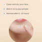 COSRX Master Patch Basic 90 pcs. – Korean hydrocolloid pimple patches