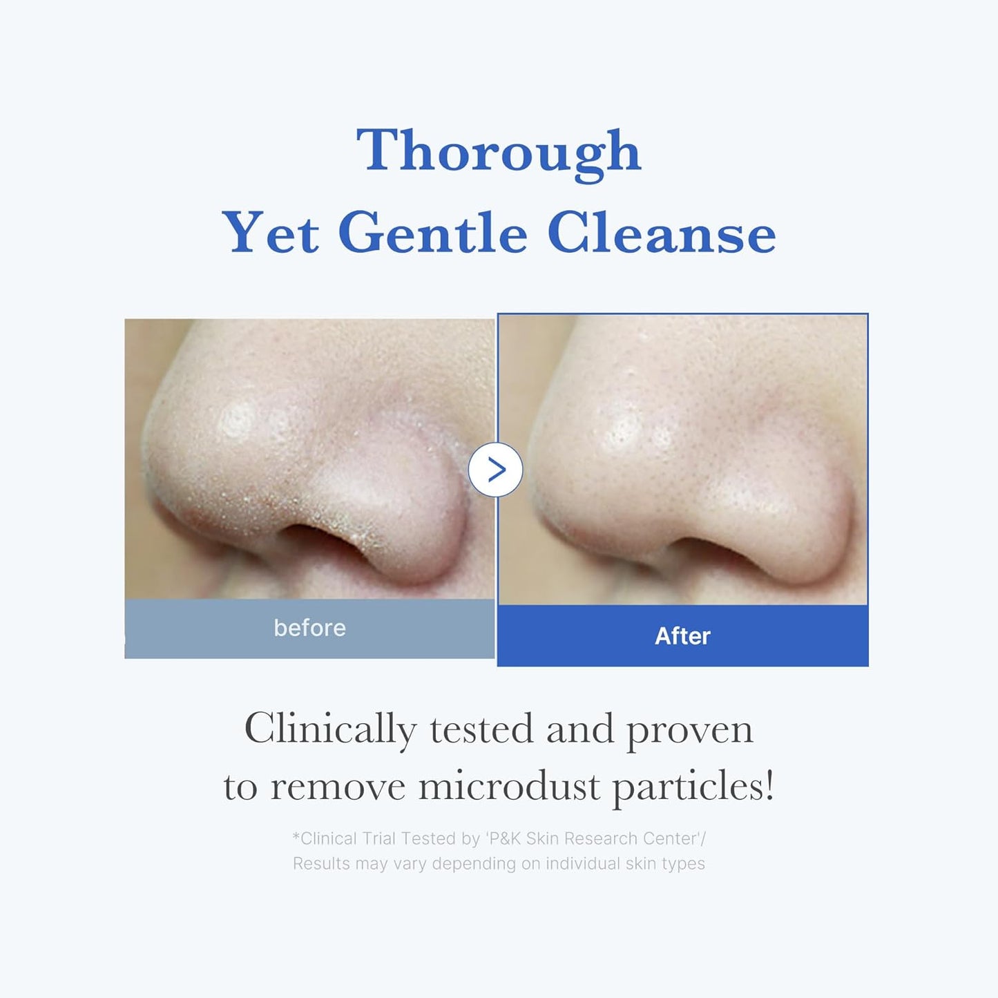 Medicube Zero Foam Cleanser 120 ml – Korean gentle facial cleansing foam