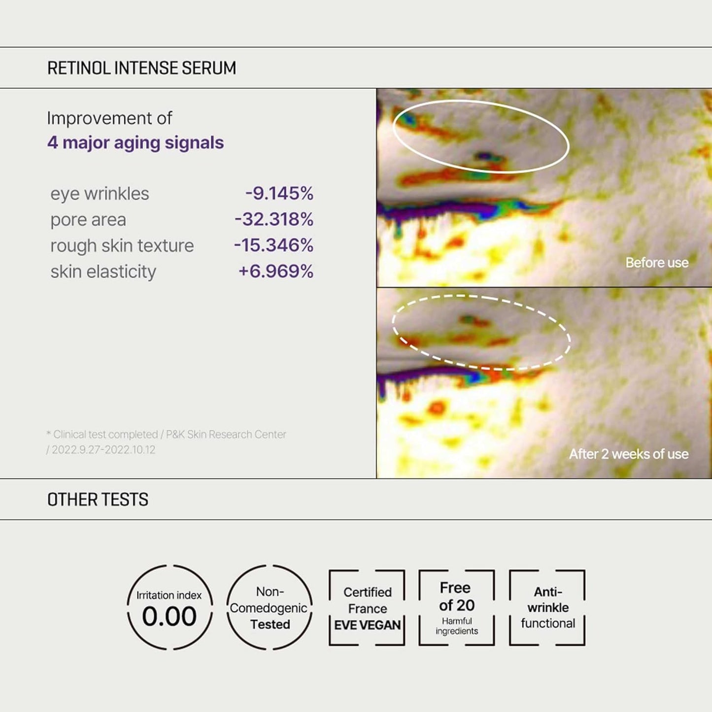 Some By Mi Retinol Intense Trial Kit – a mini retinol gift set for smoother and firmer skin