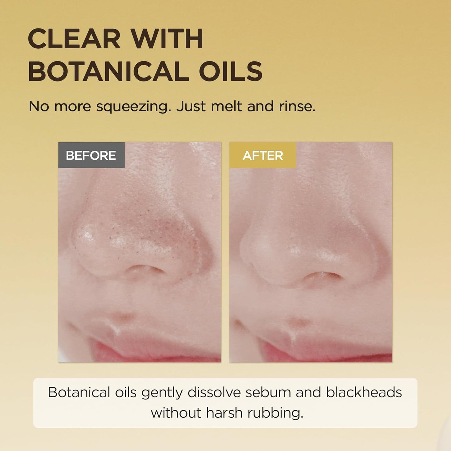 Skin1004 Madagascar Centella Light Cleansing Oil 200 ml – Korean cleansing oil with centella for gentle double cleansing.