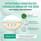 Some By Mi Micro Pin Spot Patch — 9 pcs. – Korean patches for topical treatment with micro-pins