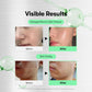 VT Cosmetics Reedle Shot 300 Microneedle Face Booster 10 × 2 ml – Korean microneedle face booster