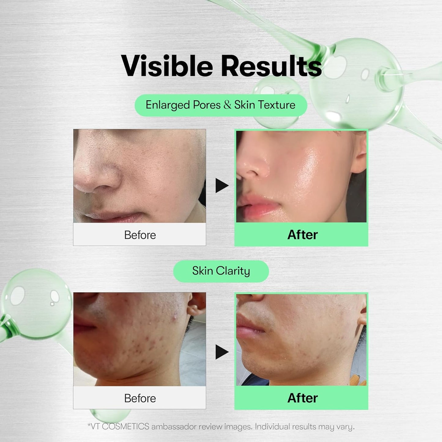 VT Cosmetics Reedle Shot 300 Microneedle Face Booster 10 × 2 ml – Korean microneedle face booster