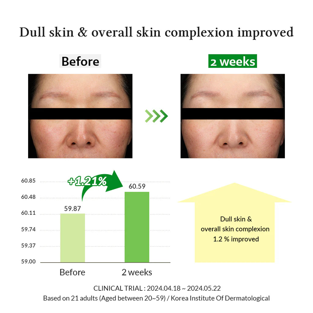 Dr. Althea Gentle Vitamin C Serum 30 ml – Korean gentle vitamin C serum for a radiant complexion.